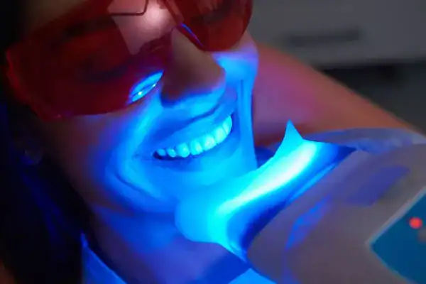 woman having teeth whitening Farnborough